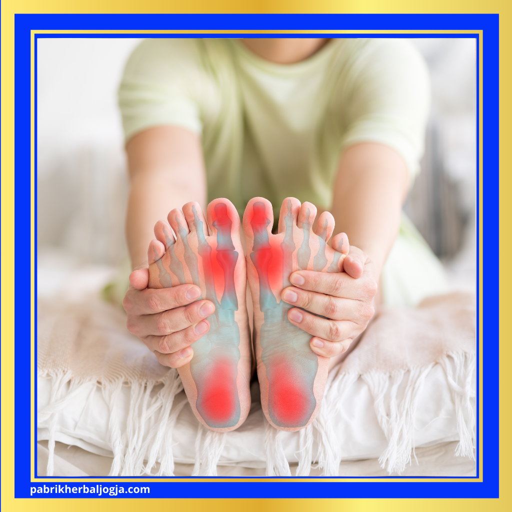 Ramuan Alami untuk Mengobati Asam Urat