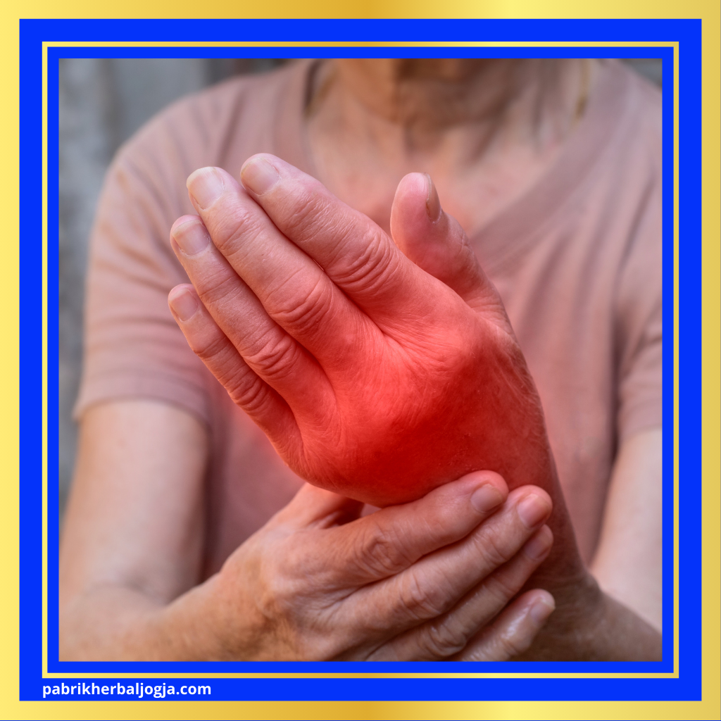 Ramuan Alami untuk Mengobati Asam Urat