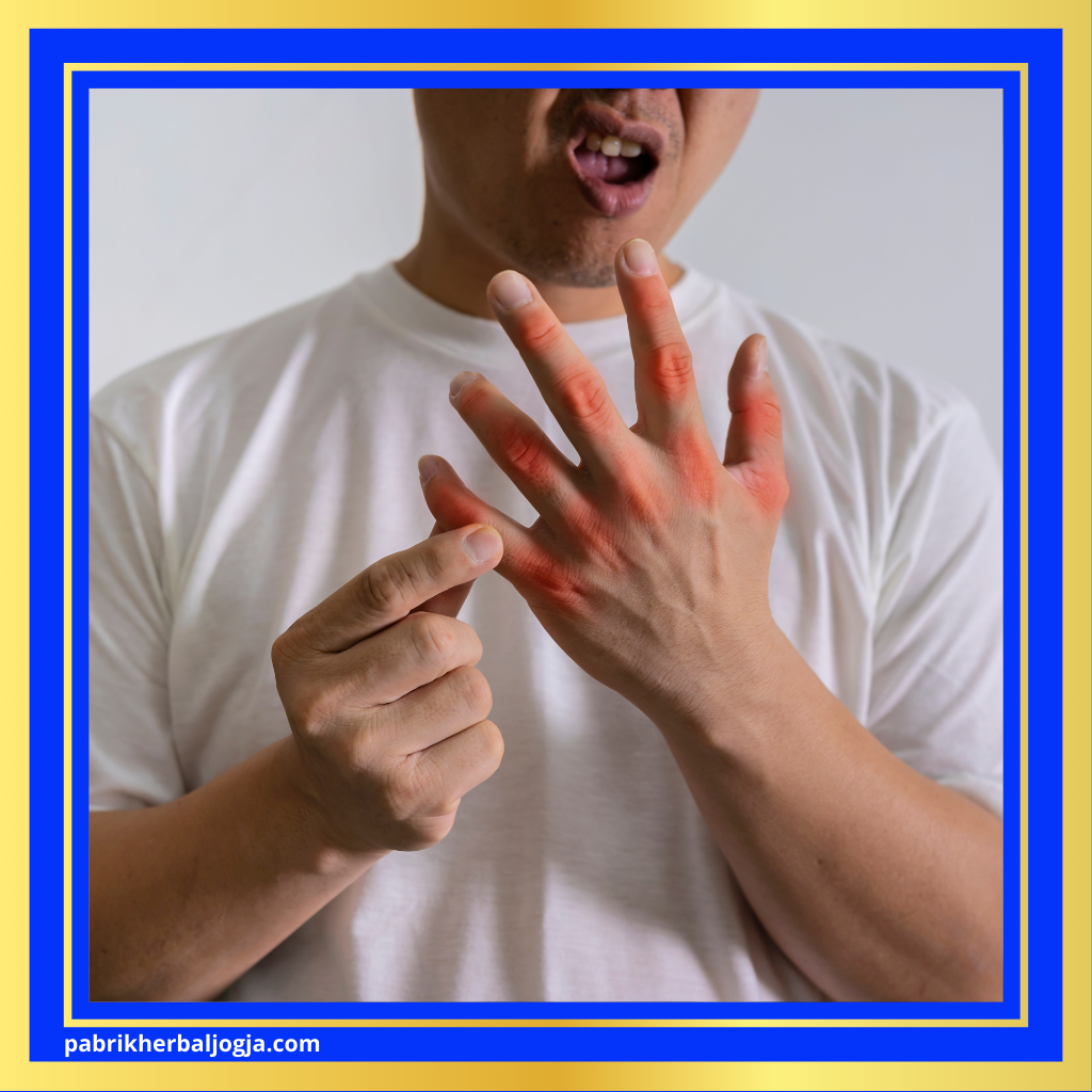 Ramuan Alami untuk Mengobati Asam Urat