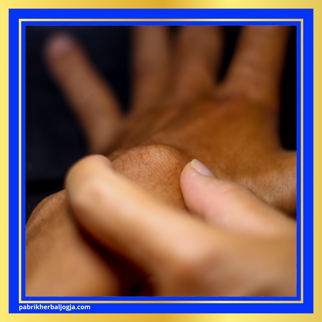 Jenis Penyakit Kista