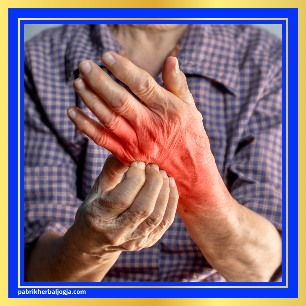 Gejala Penyakit Autoimun