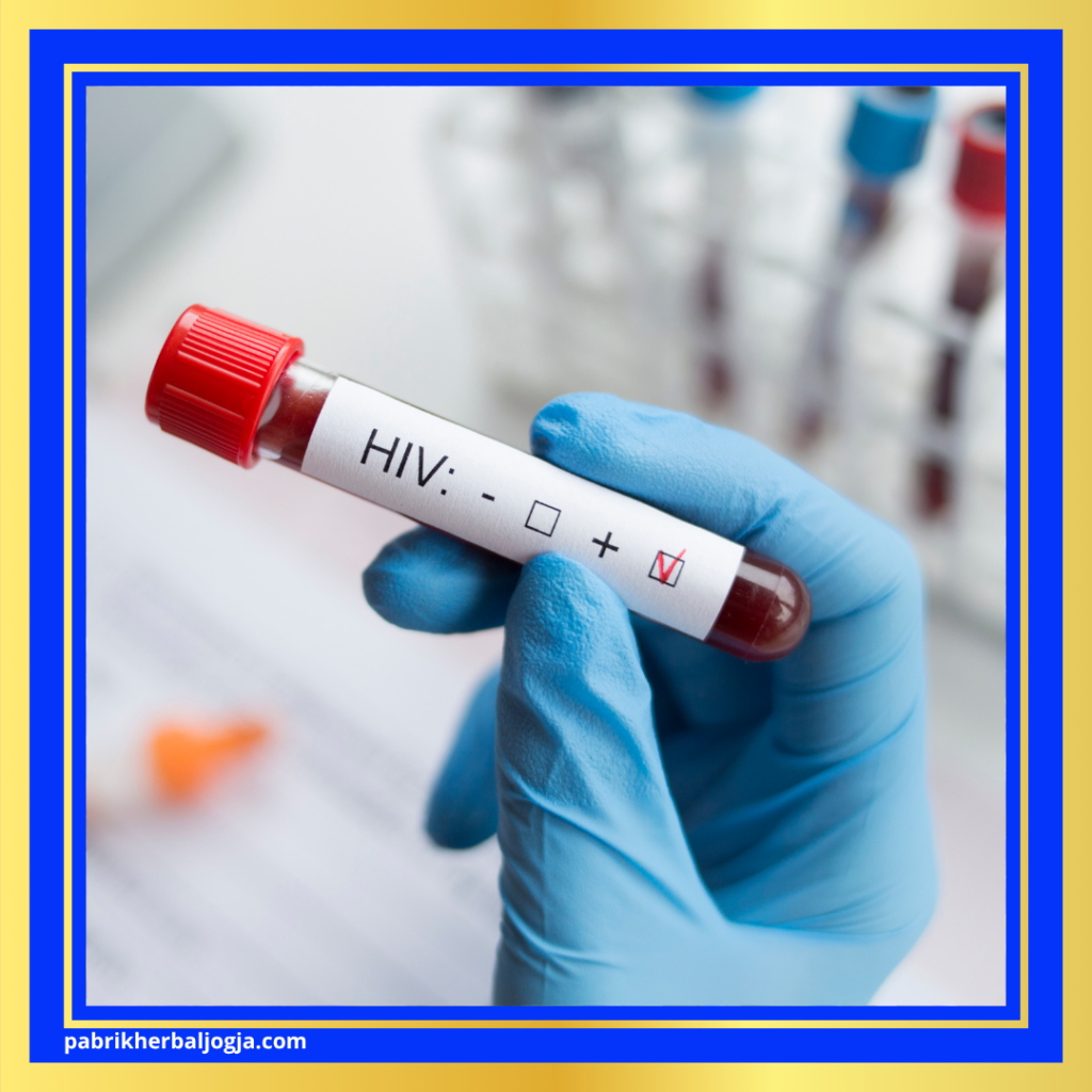 Ciri-Ciri Penyakit HIV