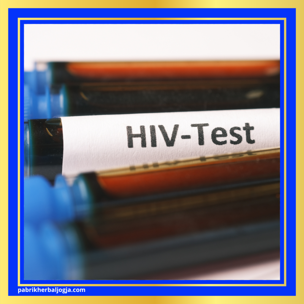 Ciri-Ciri Penyakit HIV