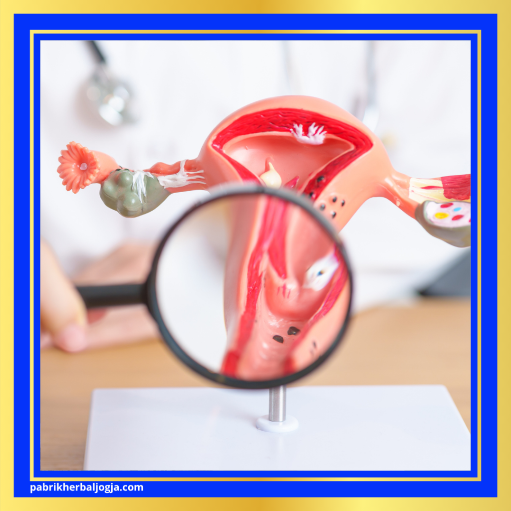 Penyebab Sakit Bawah Perut