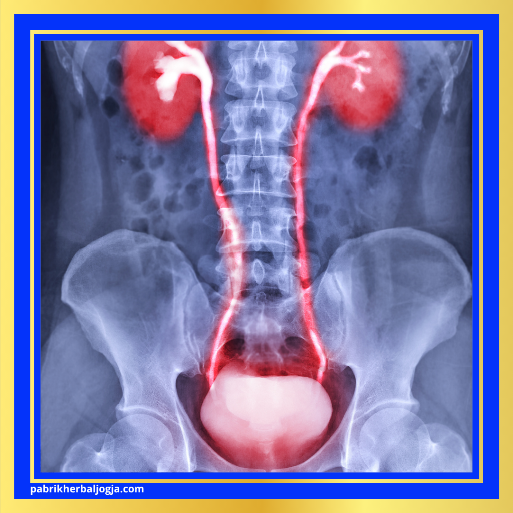 Penyebab Sakit Bawah Perut