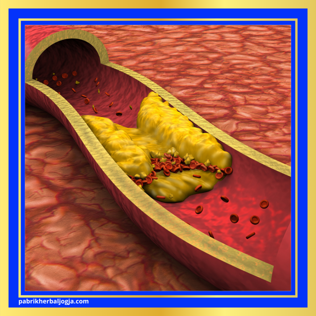 Herbal Kolesterol Tinggi